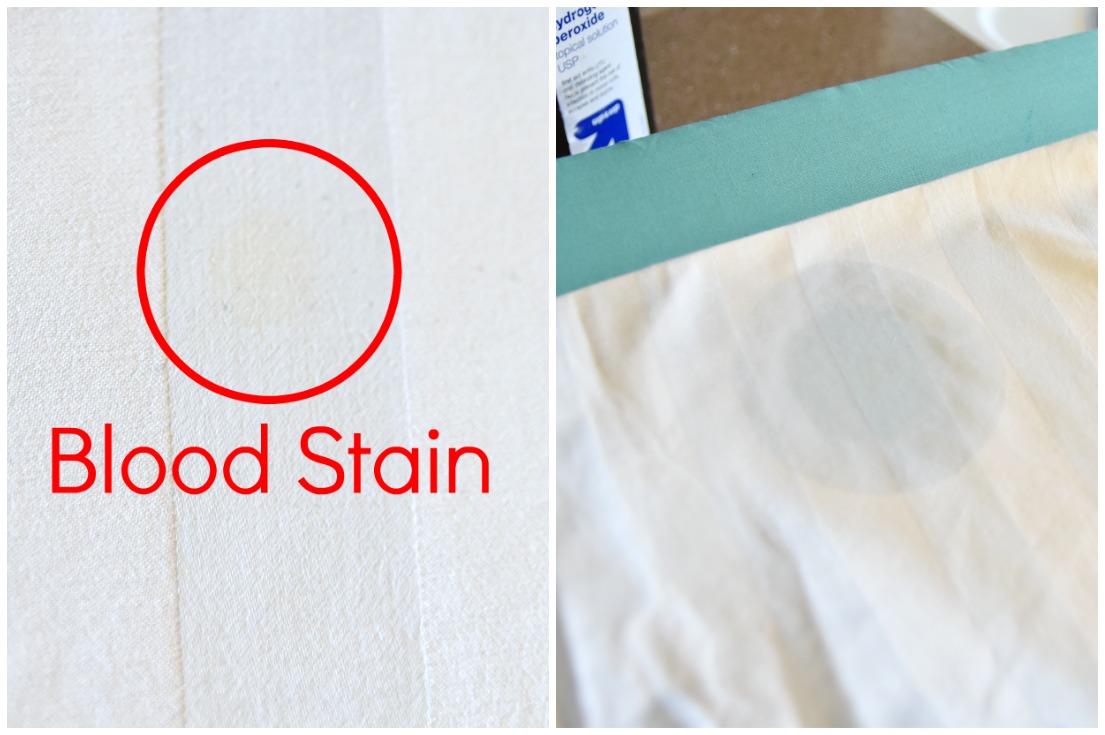 how to get blood out of white cotton sheets