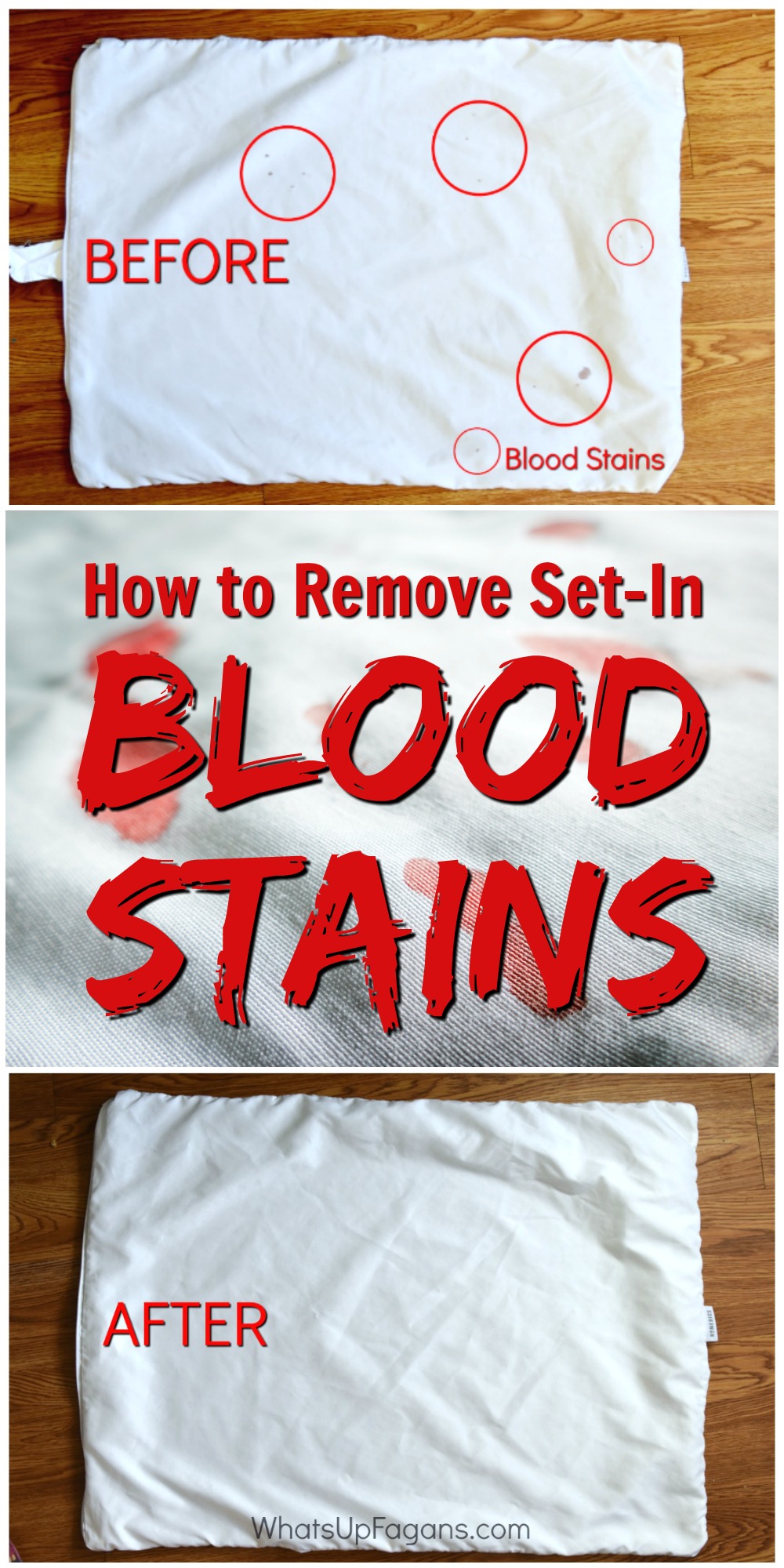 How To Remove Dried Set In Blood Stains From Clothes